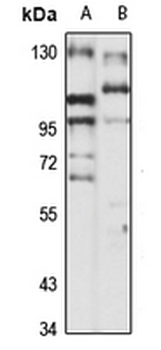 DBS Rabbit Polyclonal Antibody