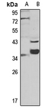 MC2 Receptor Rabbit Polyclonal Antibody