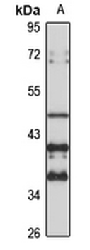 MagT1 Rabbit Polyclonal Antibody