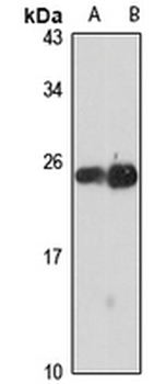 MAFG Rabbit Polyclonal Antibody