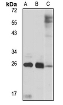 LYPLA2 Rabbit Polyclonal Antibody