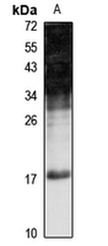 LTC4 synthase Rabbit Polyclonal Antibody