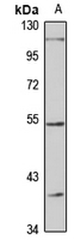 LAD1 Rabbit Polyclonal Antibody