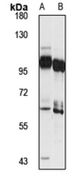 KIF3B Rabbit Polyclonal Antibody