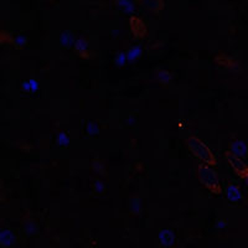 KIF17 Rabbit Polyclonal Antibody