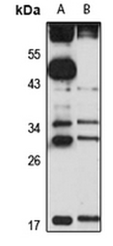 ITM2C Rabbit Polyclonal Antibody