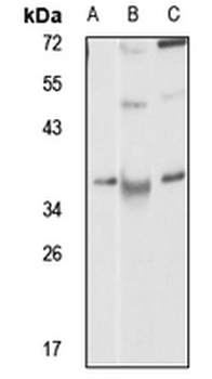 CD210b Rabbit Polyclonal Antibody