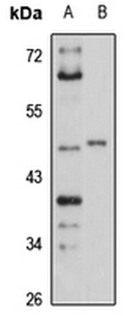 IGBP1 Rabbit Polyclonal Antibody
