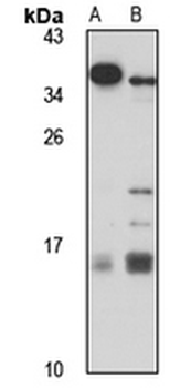 IFN alpha 2 Rabbit Polyclonal Antibody