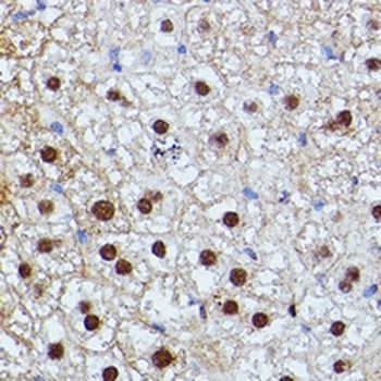 ID2 Rabbit Polyclonal Antibody
