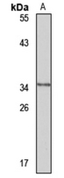 HSD17B12 Rabbit Polyclonal Antibody