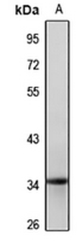 HOXC13 Rabbit Polyclonal Antibody