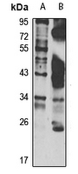 HLA-DMA Rabbit Polyclonal Antibody