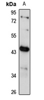 GPR32 Rabbit Polyclonal Antibody