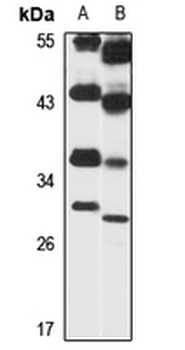 GNPDA1 Rabbit Polyclonal Antibody
