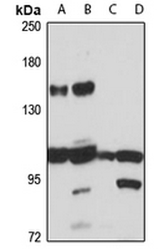 GMIP Rabbit Polyclonal Antibody