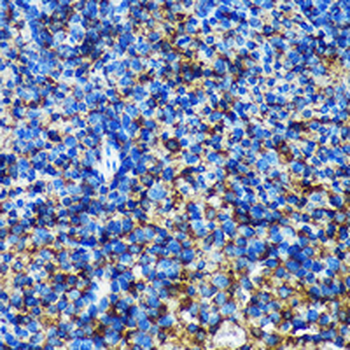 GMIP Rabbit Polyclonal Antibody
