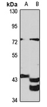 Gigaxonin Rabbit Polyclonal Antibody