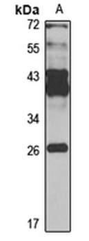 FTSJ1 Rabbit Polyclonal Antibody