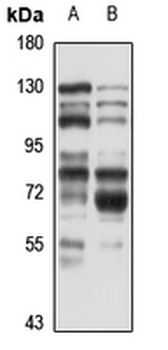 FNBP1 Rabbit Polyclonal Antibody
