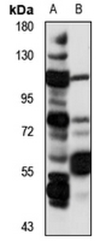 FEM1A Rabbit Polyclonal Antibody