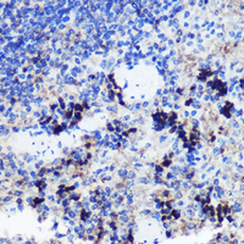 FCHSD1 Rabbit Polyclonal Antibody