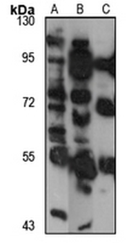 FAR1 Rabbit Polyclonal Antibody