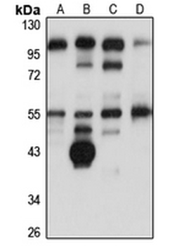 FAM46C Rabbit Polyclonal Antibody