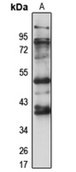 ETNK2 Rabbit Polyclonal Antibody