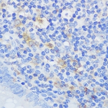 Swiprosin-1 Rabbit Polyclonal Antibody