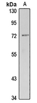 Dymeclin Rabbit Polyclonal Antibody