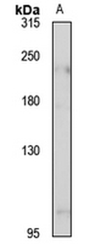 DOCK4 Rabbit Polyclonal Antibody