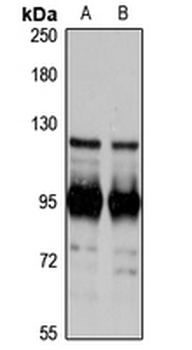 SAPAP2 Rabbit Polyclonal Antibody
