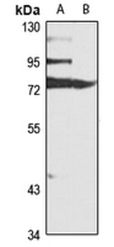 LGP2 Rabbit Polyclonal Antibody