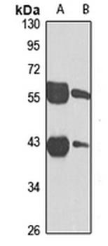 DHDH Rabbit Polyclonal Antibody