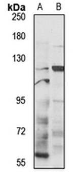 DGK zeta Rabbit Polyclonal Antibody