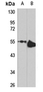 DET1 Rabbit Polyclonal Antibody