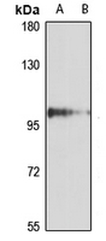DDX50 Rabbit Polyclonal Antibody