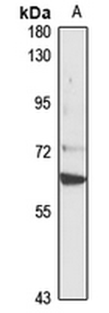DAZ1 Rabbit Polyclonal Antibody