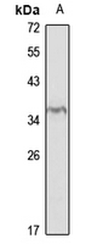 Beta-B1 crystallin Rabbit Polyclonal Antibody