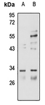 CPSF4 Rabbit Polyclonal Antibody