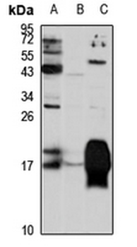Complexin-1 Rabbit Polyclonal Antibody