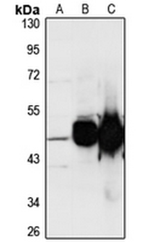 CPA2 Rabbit Polyclonal Antibody