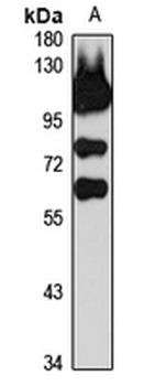 Coronin-1C Rabbit Polyclonal Antibody
