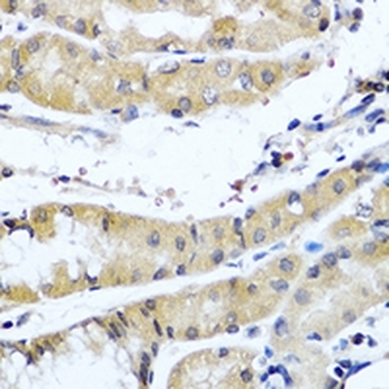 Collagen 9 alpha 1 Rabbit Polyclonal Antibody