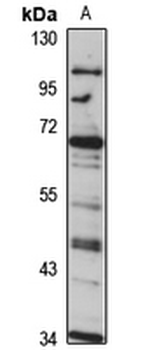 COG8 Rabbit Polyclonal Antibody