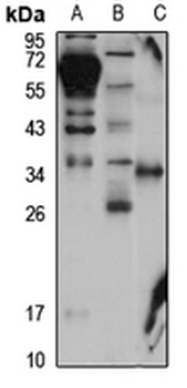 CLEC-1 Rabbit Polyclonal Antibody