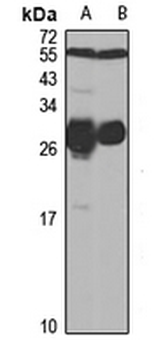 CKS1 Rabbit Polyclonal Antibody