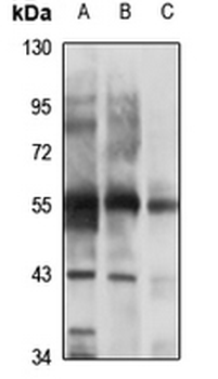CHRNB3 Rabbit Polyclonal Antibody