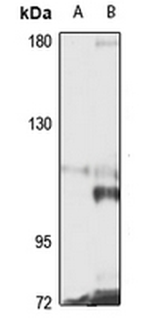 CEP120 Rabbit Polyclonal Antibody